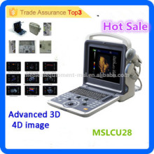 2016 Latest brand MSLCU28I 3d/4d laptop/portable color doppler ultrasound/color doppler ultrasound equipment price
